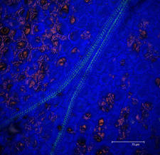 Periwinkle (Littorina littorea) flower petal series scan