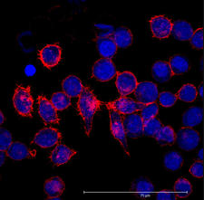 Hela cells