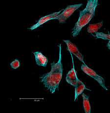 PC3 cells