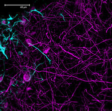 Rat brain section