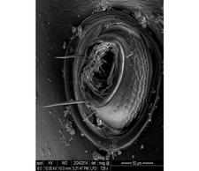 Bartholemu the Centipede's eye