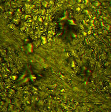 Autofluorescent Hydrangea Petal (Hydrangea macrophylla) 