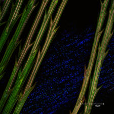 Autofluorescent Dandelion Petal (Taraxacum officinale)