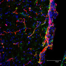 Mouse Brain Section