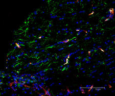 Rat brain section