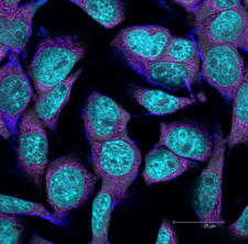 MitoTracker cells