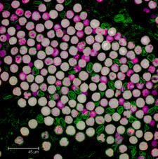 Maximum projection image of pollen grains from Hydrangea macrophylla