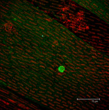 Average projection image of Dicranum scroparium