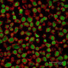 Maximum projection image of Paeonia lactiflora pollen grains