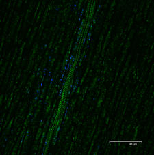 Single scan image of Symphyotrichum pilosum
