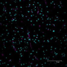 Average/Maximum projection of a series scan image of rat brain section