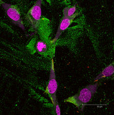 B16 Cells
