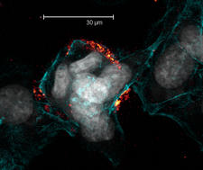 B16 Cells