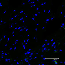 Single scan image of rat brain section