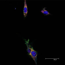 Single scan image of B16 cells