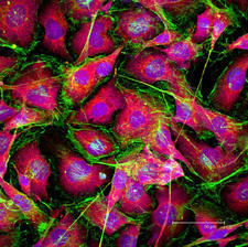 Maximum projection of B16 cells