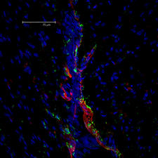 Rat brain sections