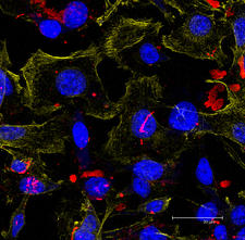 B16 cells